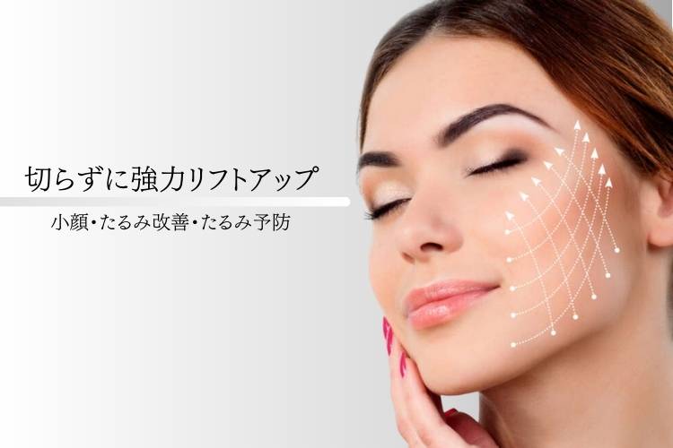 糸のリフトアップを受ける女性