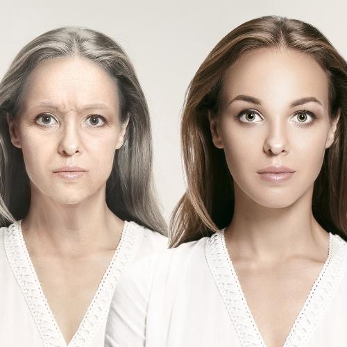 ヒアルロン酸 福岡天神でヒアルロン酸注射が上手なクリニック トータルスキンクリニック