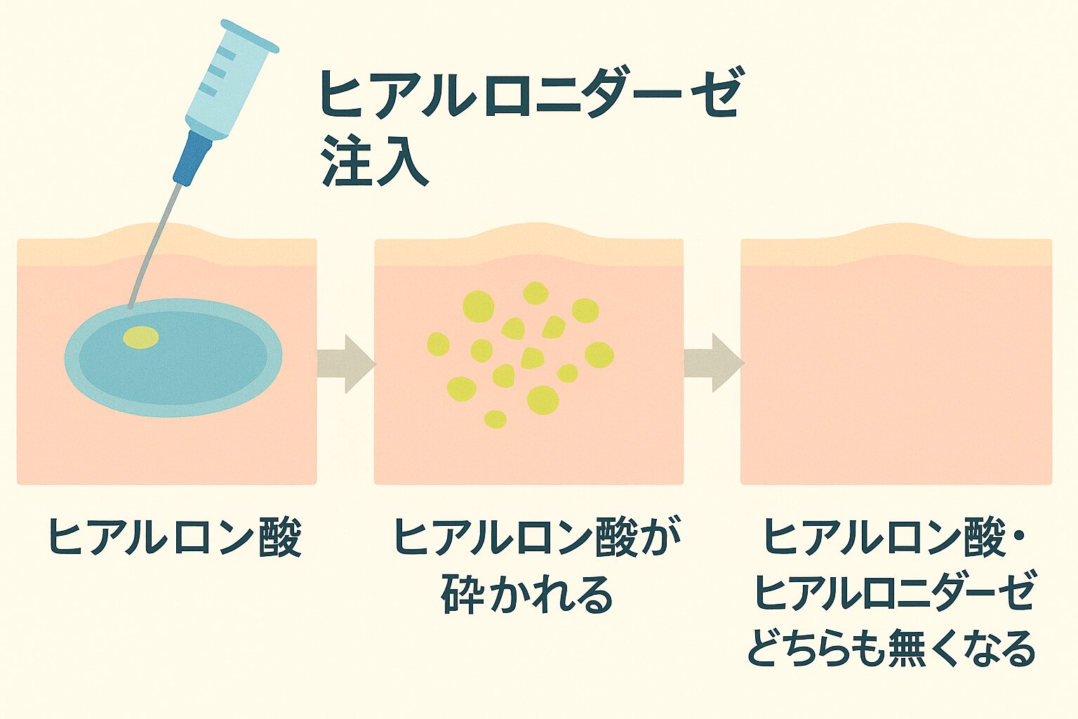 ヒアルロニダーゼの仕組み