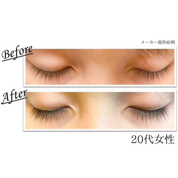evobeaute evoeye アイラッシュフォーミュラ - 画像 (3)