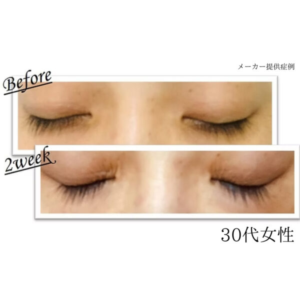 evobeaute evoeye アイラッシュフォーミュラ - 画像 (4)