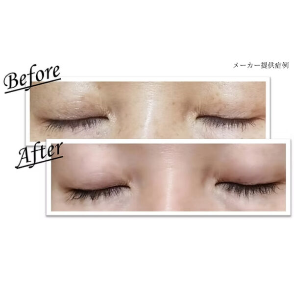evobeaute evoeye アイラッシュフォーミュラ - 画像 (5)