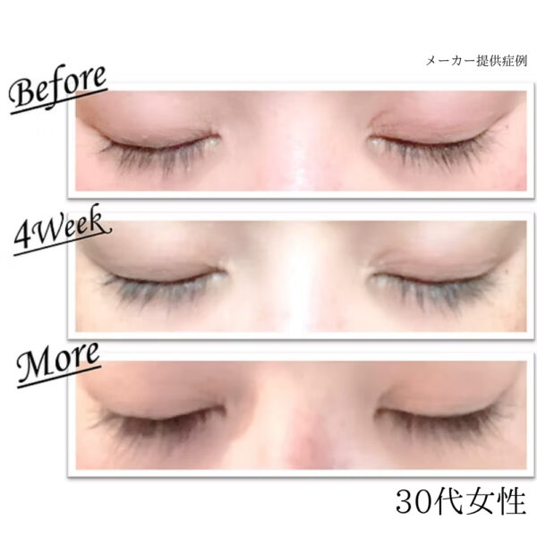 evobeaute evoeye アイラッシュフォーミュラ - 画像 (6)