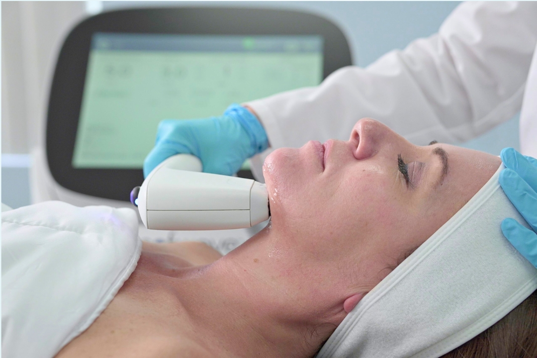 ソフウェーブ(sofwave)