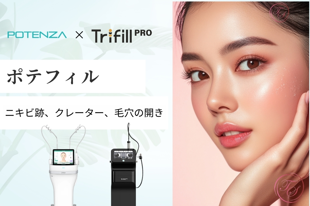 ポテンツァ・ポテフィル｜ニキビ跡・クレーター治療｜福岡・天神・大名