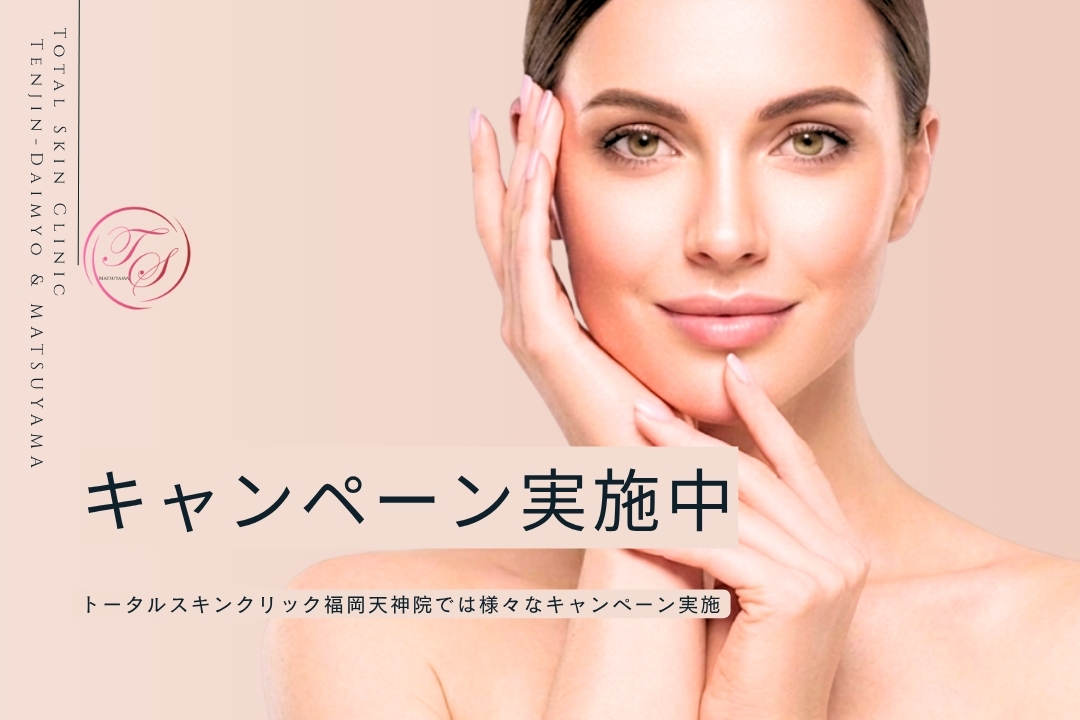 「キャンペーン実施中」 トータルスキンクリック福岡天神院では様々なキャンペーン実施 (トータルスキンクリニック 天神大名院)