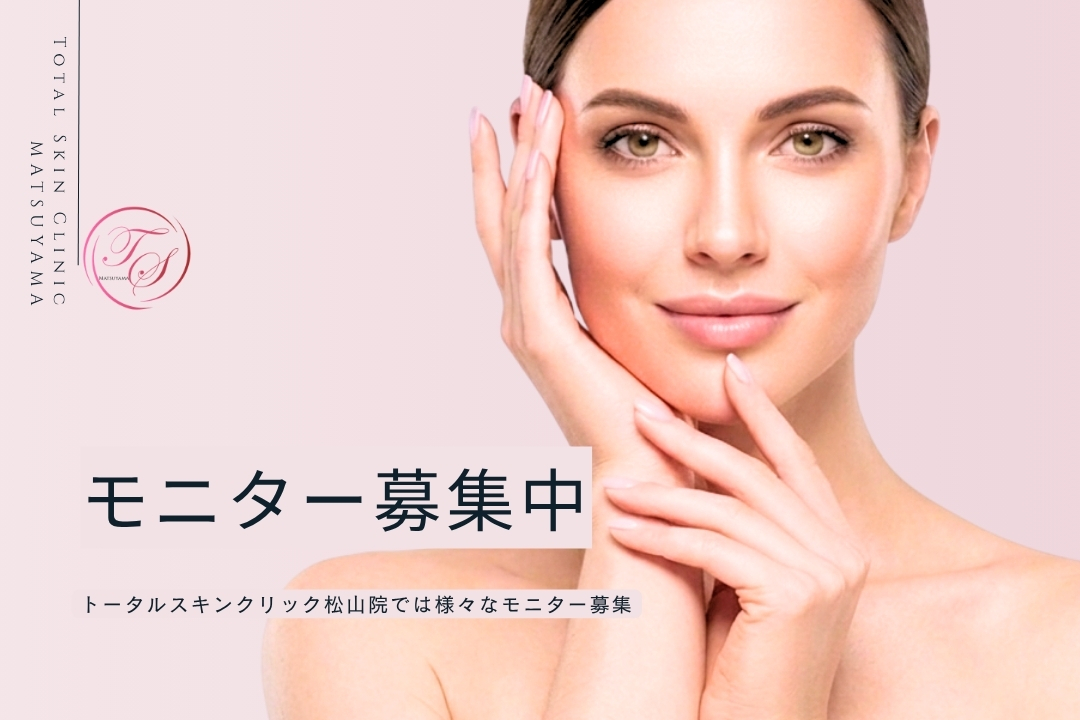 「モニター募集中」 トータルスキンクリック 松山院では様々なモニター募集中 （トータルスキンクリニック 松山院）
