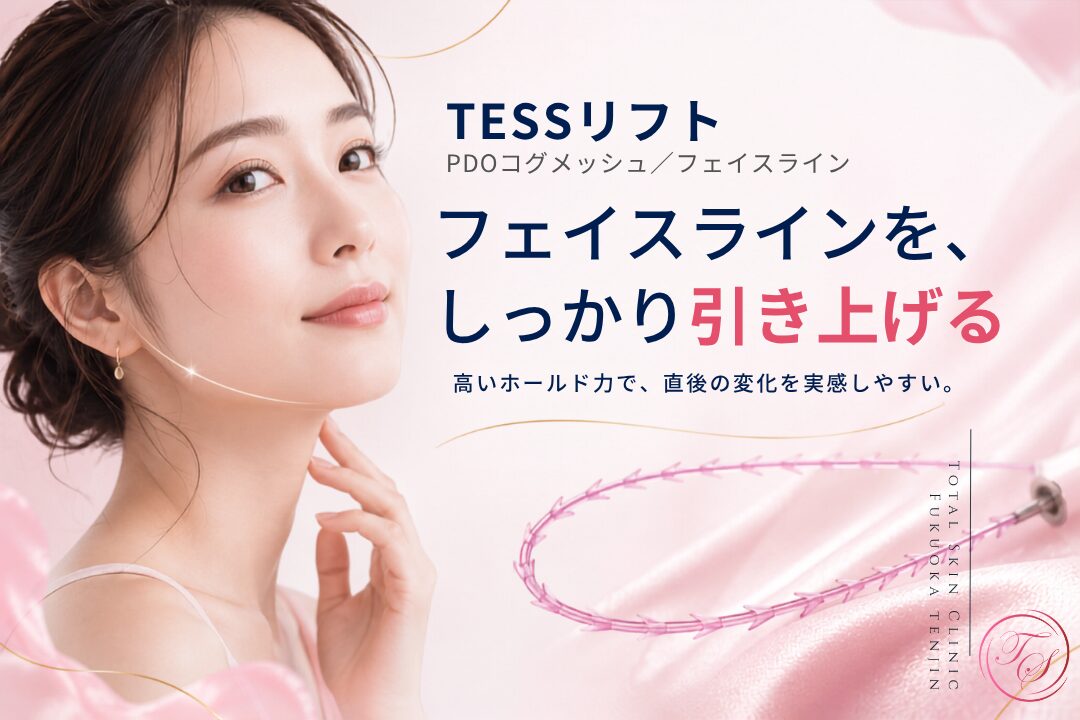 TESSリフトはPDO素材のコグメッシュ糸で、フェイスラインをしっかりホールドして引き上げる糸リフト施術として、トータルスキンクリニック 福岡天神院で使用している製品です。