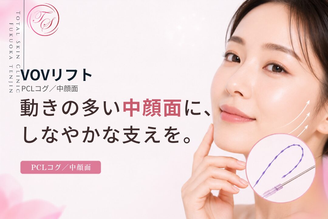 VOVリフトはPCL素材の柔軟なコグ糸で、表情の動きが大きい中顔面に適した糸リフトとして、トータルスキンクリニック 福岡天神院でほうれい線や口角周囲のリフトアップに使用している製品です。