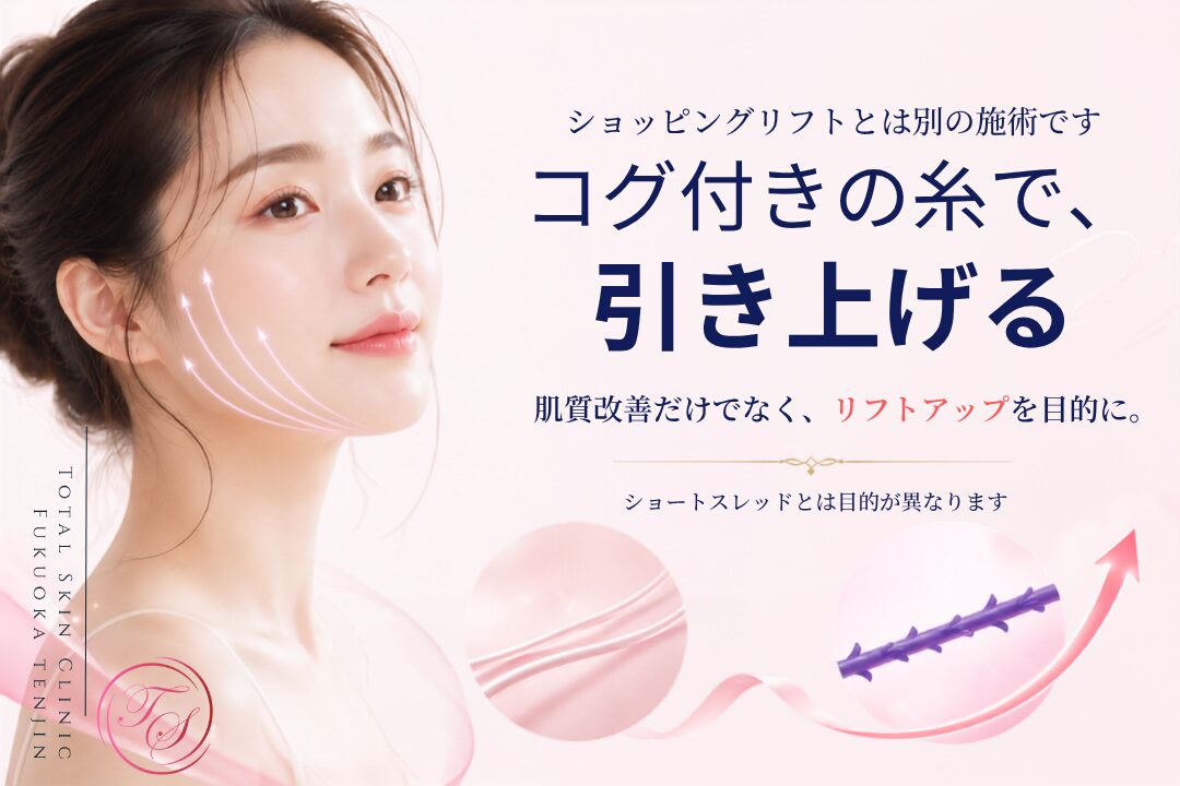 ショッピングリフトとは異なるコグ付き糸を使用し、フェイスラインを物理的に引き上げる糸リフト施術を紹介するトータルスキンクリニック 福岡天神院の美容医療画像。