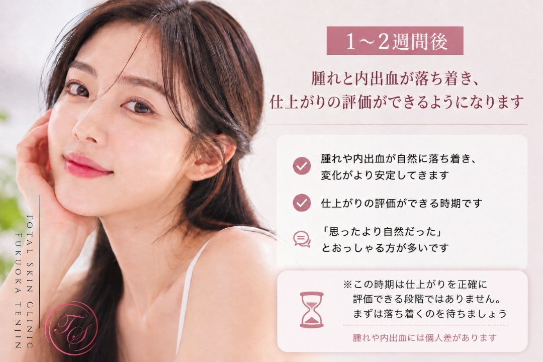 ヒアルロン酸注入後1〜2週間の経過として、腫れや内出血が落ち着き、仕上がりの評価ができる時期を解説した美容クリニック向け画像。自然な仕上がりを希望する方への注入治療の経過説明。(トータルスキンクリニック 福岡天神院)