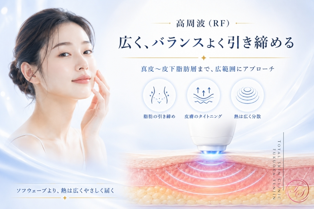 ソフウェーブは真皮1.5mmを集中的に加熱して皮膚を引き締める治療ですが、筋膜や脂肪層の崩れが主な原因のたるみには単体での効果に限界があります。(トータルスキンクリニック 福岡天神院)