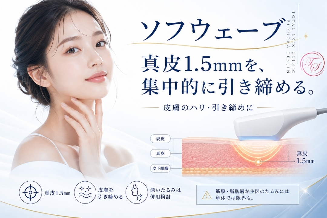 ソフウェーブは真皮1.5mmを集中的に加熱して皮膚のハリや引き締めを促す治療ですが、筋膜や脂肪層が原因のたるみには単体での効果に限界があります。(トータルスキンクリニック 福岡天神院)