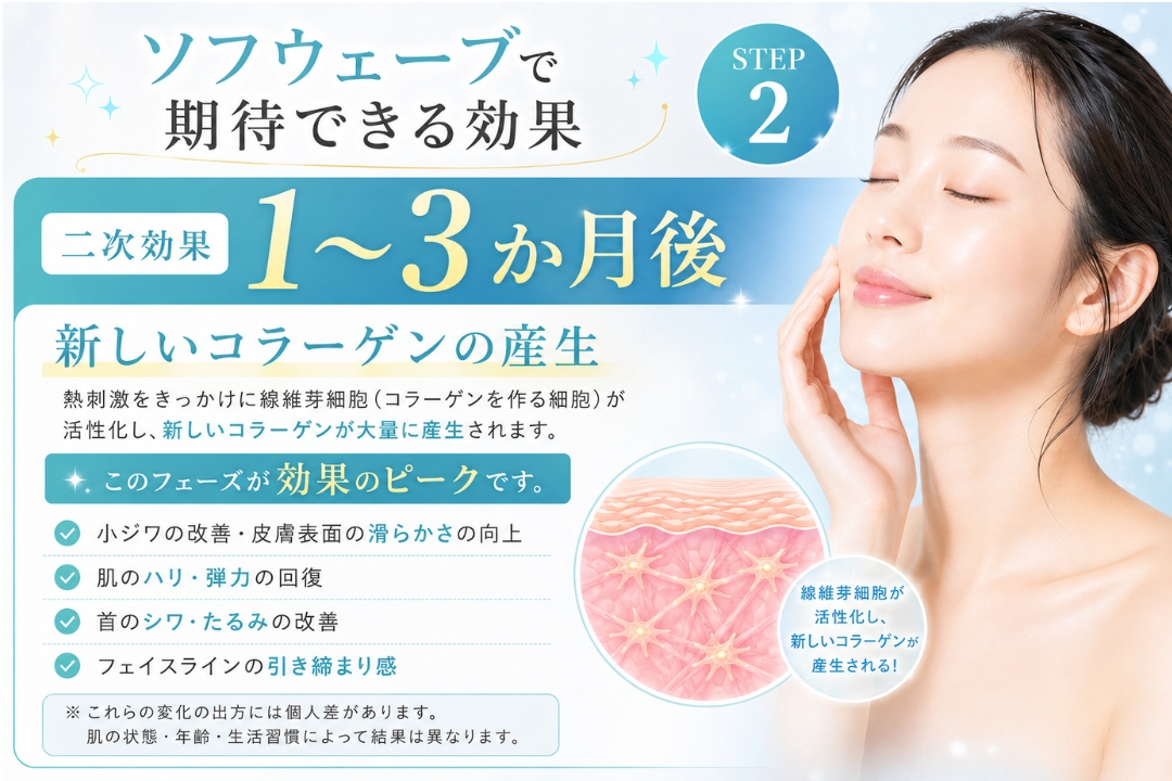 効果の持続:半年〜1年程度 個人差はありますが、効果は概ね半年〜1年ほど持続します。 新しく作られたコラーゲンは肌の資産として残りますが、加齢とともに少しずつ元の状態に戻っていきます。(トータルスキンクリニック 福岡天神院)