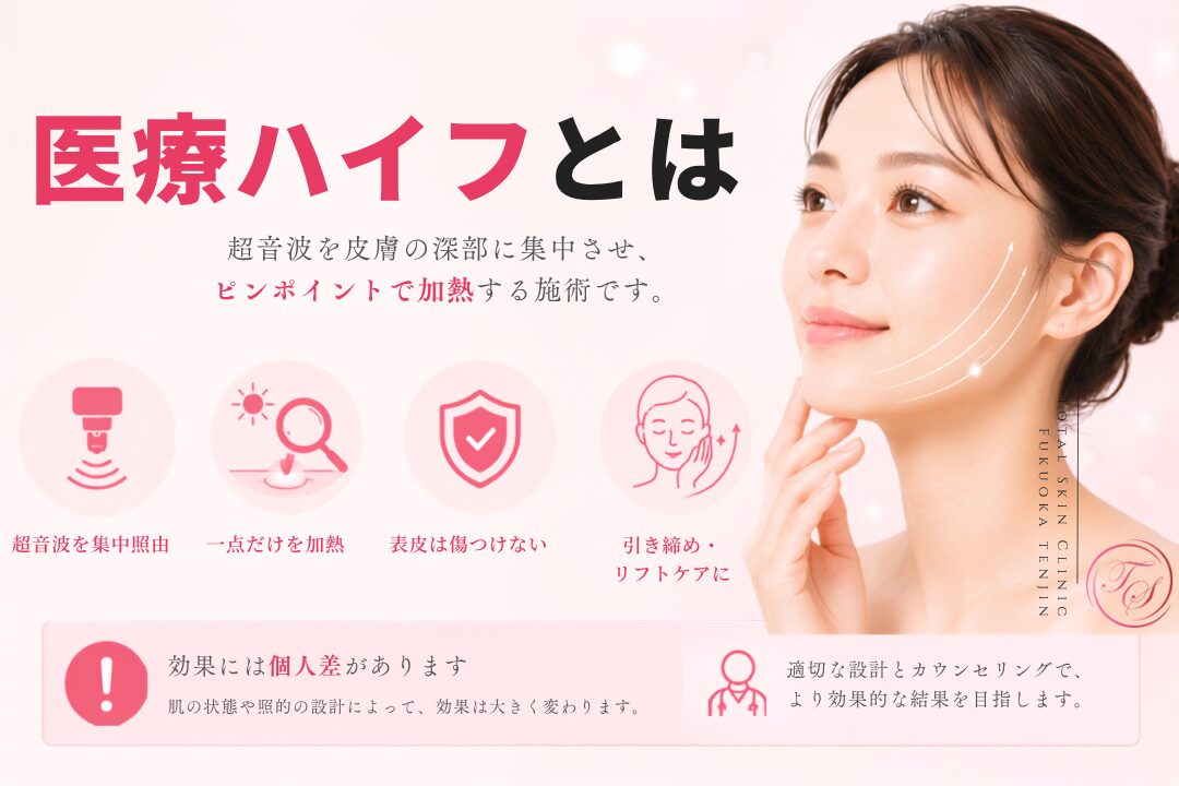 医療ハイフは高密度焦点式超音波を皮膚深部へ集中させ、表皮を傷つけずにたるみやフェイスラインの引き締めを目指す施術です。トータルスキンクリニック 福岡天神院がHIFUの仕組みと特徴を紹介する美容医療画像。