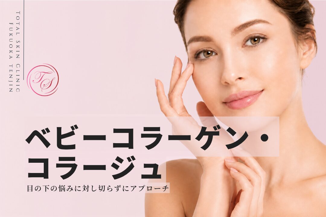 ベビーコラーゲン・コラージュ。目の下の悩み(特に、窪み・凹み)に対して、切らずにアプローチ(トータルスキンクリニック 福岡天神院)