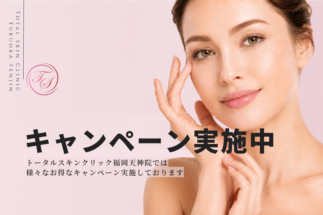 「キャンペーン実施中」 トータルスキンクリック福岡天神院では様々なキャンペーン実施 （トータルスキンクリニック 福岡天神院）