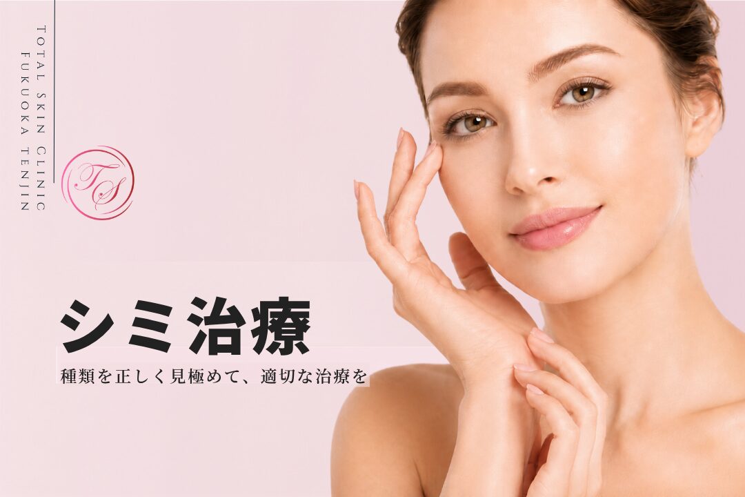 シミ治療|種類を正しく見極めて、適切な治療を(トータルスキンクリニック 福岡天神院)