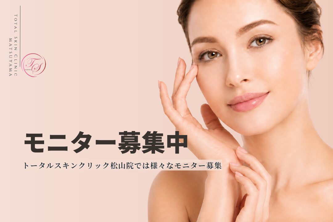 「モニター募集中」 トータルスキンクリック 松山院では様々なモニター募集中