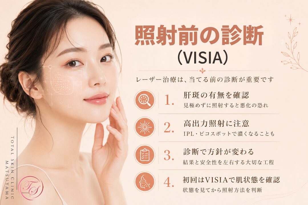 照射前の診断(VISIA)の重要性を紹介する美容医療記事用画像|レーザー治療前にVISIAで肌状態や肝斑の有無を確認し、シミ・くすみ治療で悪化リスクに配慮しながら適切な照射方針を判断する内容|トータルスキンクリニック 松山院