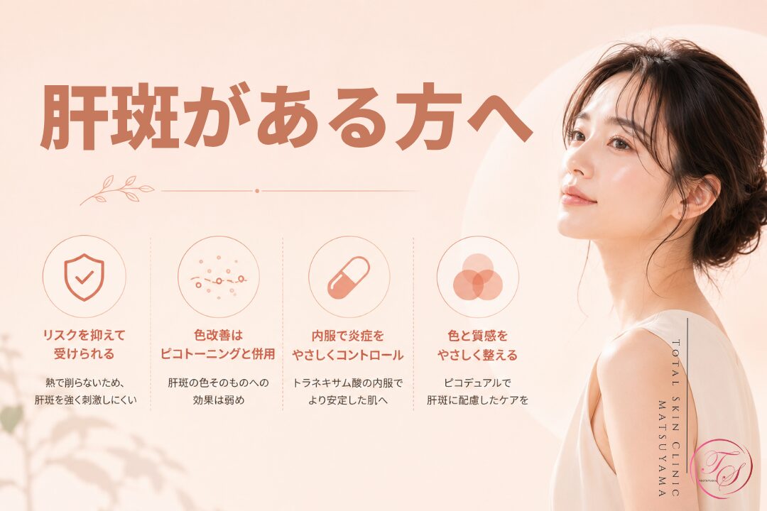 肝斑がある方に向けた美容医療記事用画像|肌への刺激に配慮しながら、ピコトーニングやトラネキサム酸内服、ピコデュアルを組み合わせて色味と肌質を少しずつ整える考え方を紹介|トータルスキンクリニック 松山院