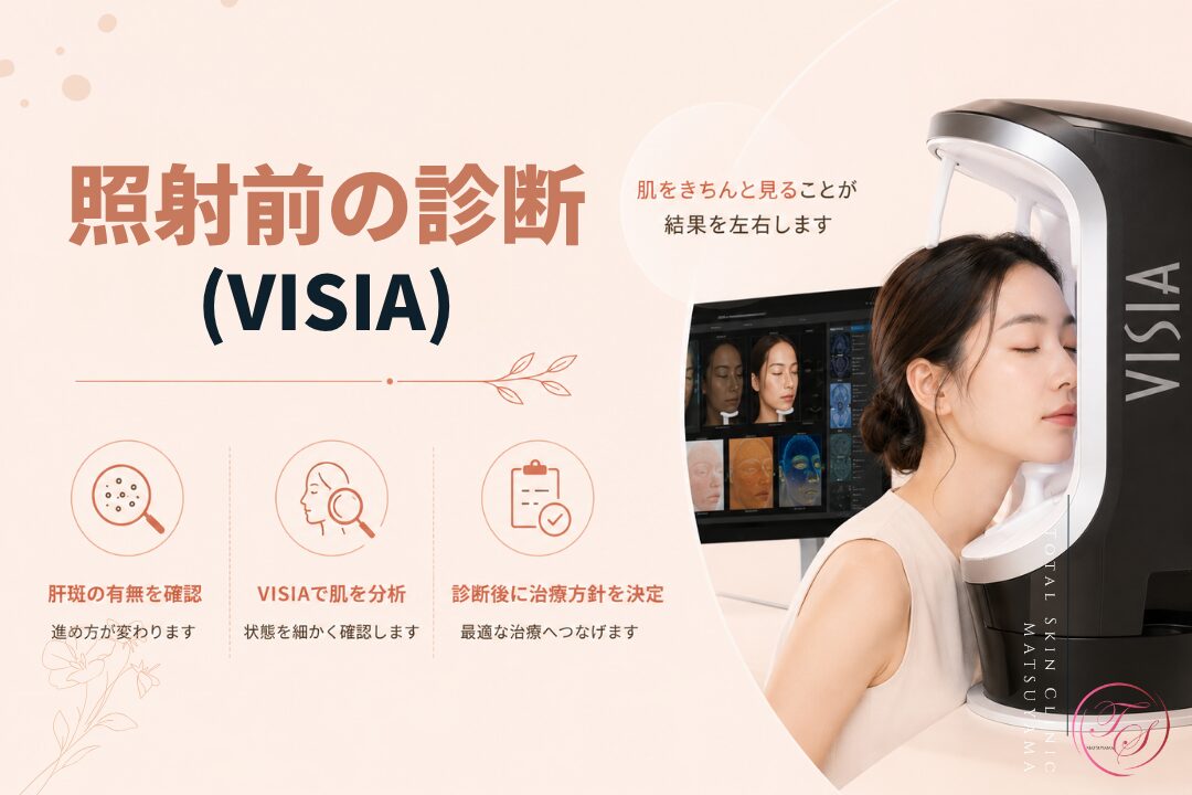 レーザー照射前に行うVISIA肌診断の重要性を紹介する美容医療記事用画像|肝斑の有無や肌状態を確認し、診断結果をもとに適切な治療方針を決める流れを表現|トータルスキンクリニック 松山院