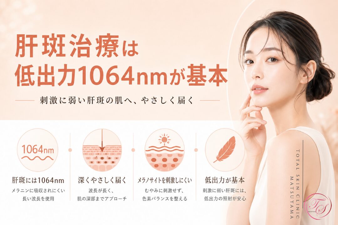 肝斑治療で低出力1064nmレーザーが基本となる理由を、メラニンへの吸収特性や皮膚深部への到達、刺激を抑えた照射の考え方とともに紹介する美容医療記事用画像｜トータルスキンクリニック 松山院