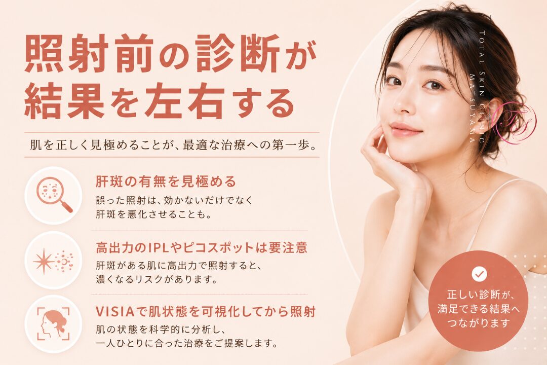 レーザー照射前にVISIAで肝斑やシミの状態を見極め、高出力のIPLやピコスポットによる色素沈着の悪化リスクに配慮しながら適切な施術を選ぶ重要性を紹介する美容医療記事の画像｜トータルスキンクリニック松山院