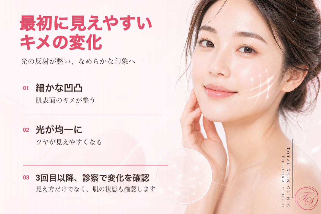 ジェネシスで比較的早く確認しやすいキメの変化と、肌表面の凹凸や光の反射が整う過程を紹介する美容医療記事用画像|トータルスキンクリニック福岡天神院