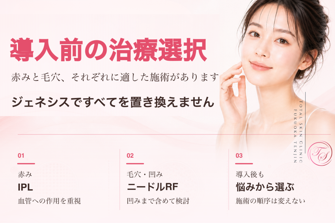 赤みにはIPL、毛穴の凹みにはニードルRFを検討し、ジェネシス導入後も肌悩みに応じて施術を選ぶ考え方を紹介する美容医療記事用画像|トータルスキンクリニック福岡天神院
