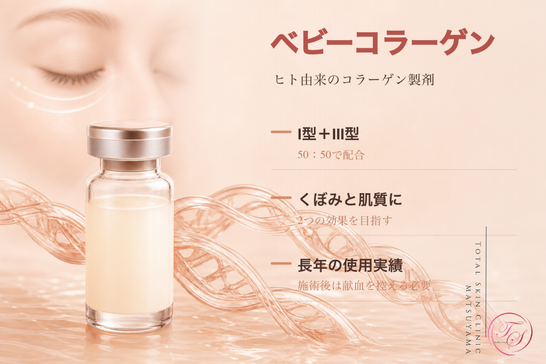 ヒト由来のベビーコラーゲンがⅠ型とⅢ型コラーゲンを50対50で含み、目の下のくぼみと肌質へアプローチすることを紹介する画像|トータルスキンクリニック 松山院