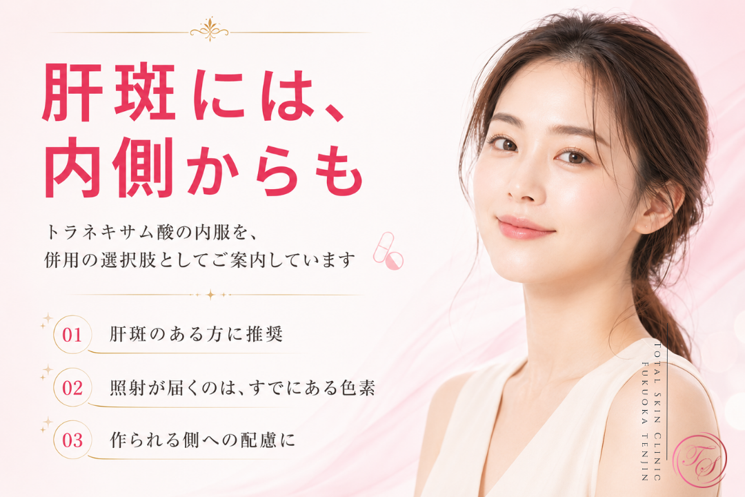 肝斑のある方に、ジェネシス・レーザートーニングとトラネキサム酸内服の併用を提案し、色素が作られる側にも配慮する治療方針を表現|トータルスキンクリニック 福岡天神院