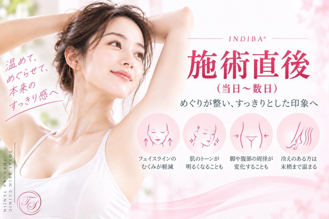 インディバ（INDIBA®）施術直後から数日の変化を紹介。フェイスラインのむくみ、肌トーンの明るさ、脚や腹部の周径変化、冷えのある方の末梢までの温まりなど、施術後に確認されることがある一時的な変化を表現｜トータルスキンクリニック福岡天神院