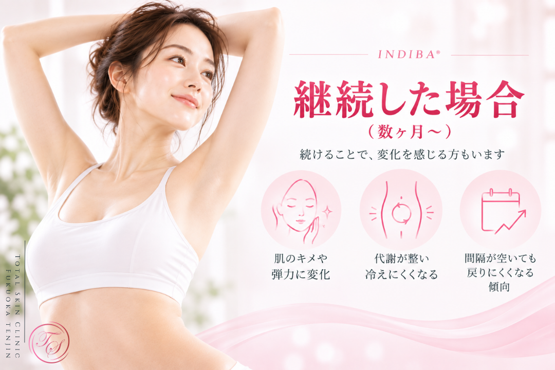 インディバ（INDIBA®）を数ヶ月継続した場合に見られることがある変化を紹介。肌のキメや弾力、冷えにくさ、間隔が空いても元の状態に戻りにくくなる傾向を表現し、変化には個人差や生活習慣の影響があることも踏まえている｜トータルスキンクリニック福岡天神院