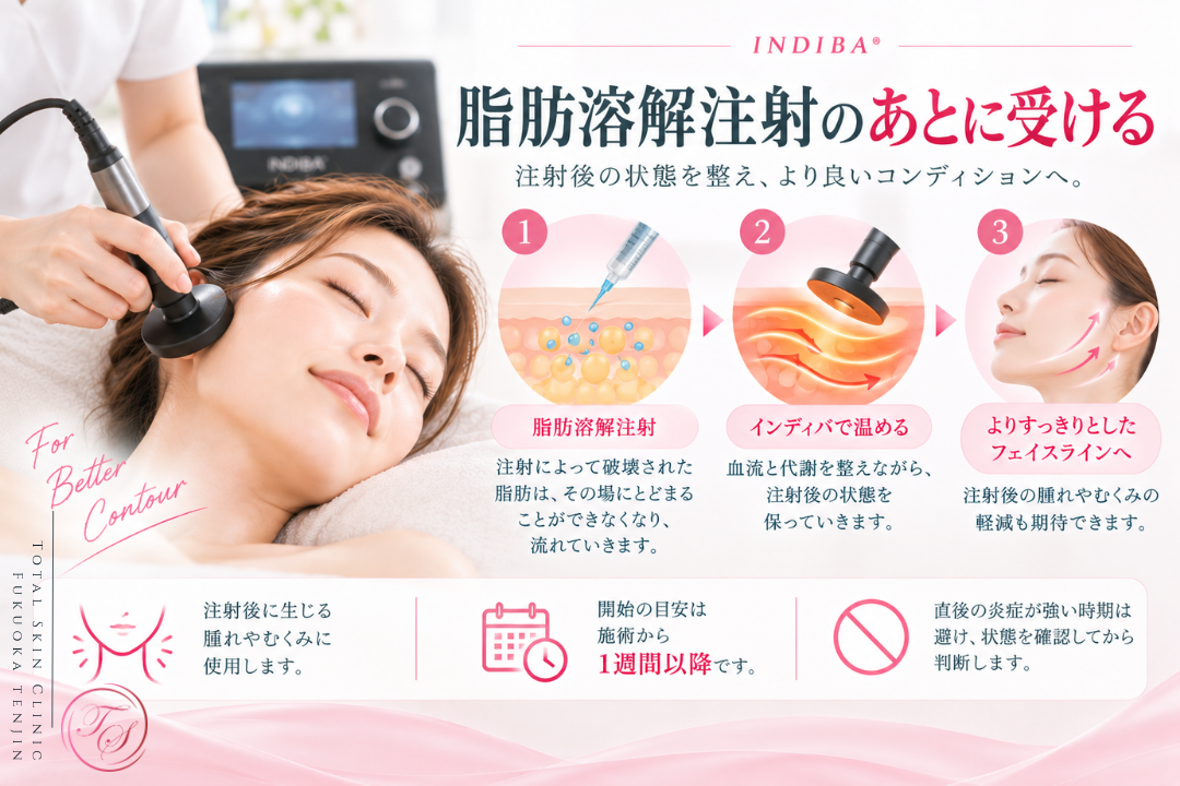 脂肪溶解注射後にインディバ（INDIBA®）を受ける流れを紹介。注射後の腫れやむくみのケア、血流や代謝を整える目的で、炎症が落ち着いた施術1週間以降を目安に状態を確認しながら行うことを表現｜トータルスキンクリニック福岡天神院